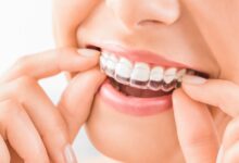 Invisalign in Ellicott City