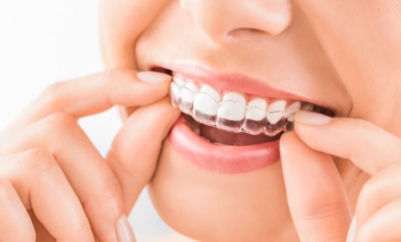 Invisalign in Ellicott City